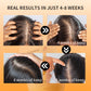 Anti-Hair Loss Shampoo